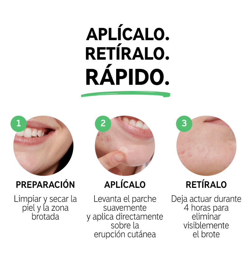 Never Pimp ( 30 unidades )