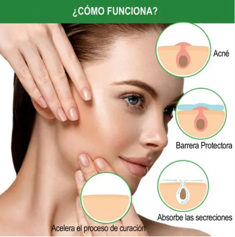 Never Pimp ( 30 unidades )