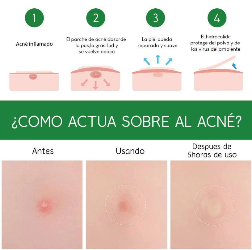 Never Pimp ( 30 unidades )